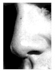 nose.jpg (4665 bytes)